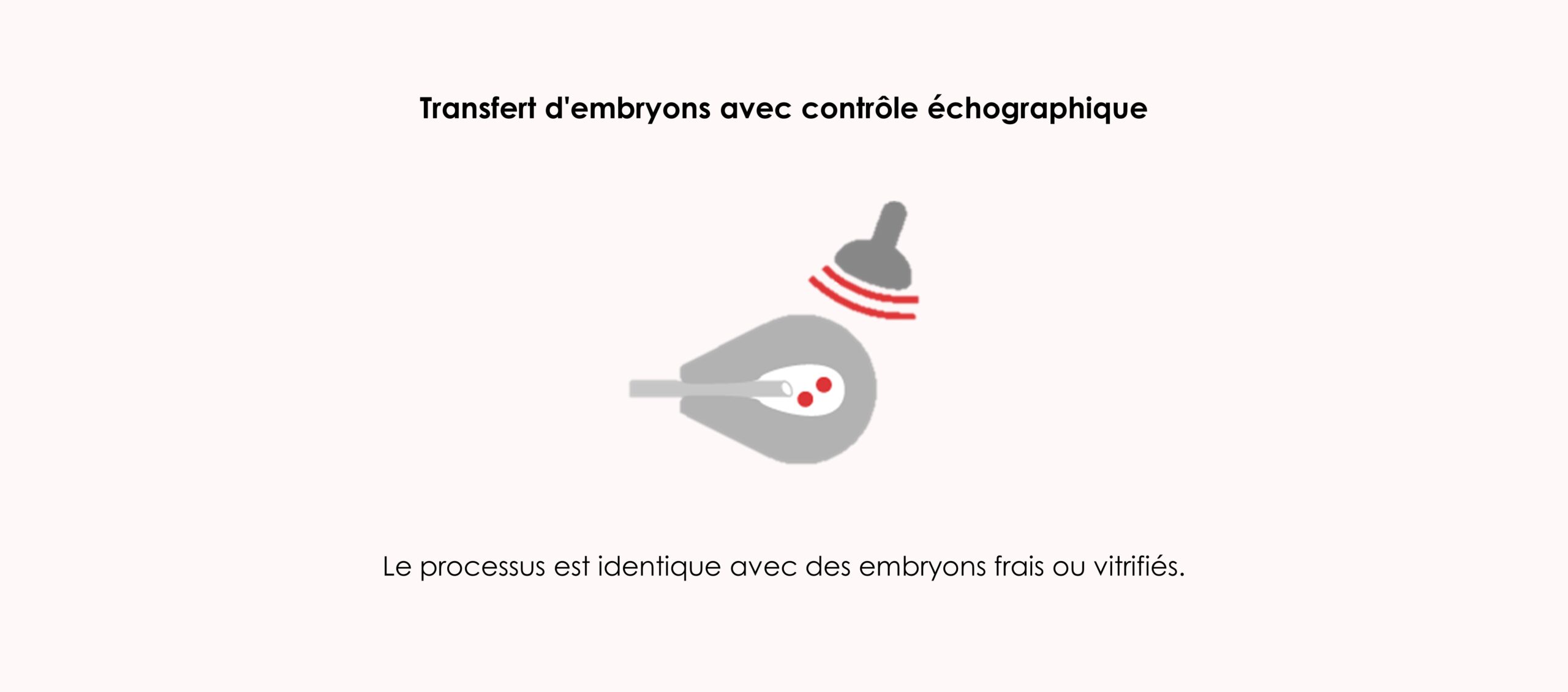 Est-il préférable de transférer des embryons frais ou vitrifiés ?